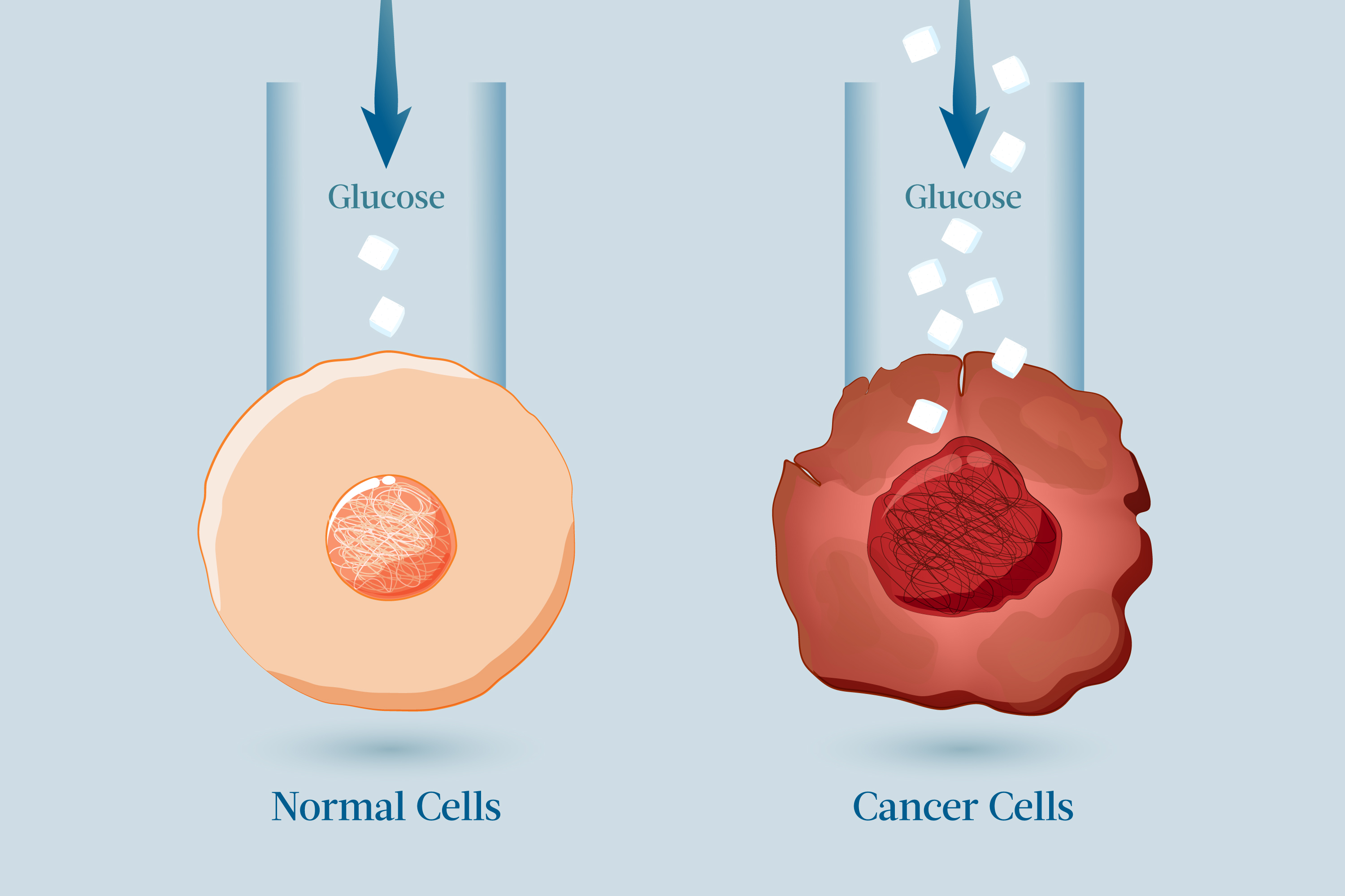 Cancer cells consume sugar at a rate 200 times faster than normal cells. (Illustration by The Epoch Times, Shutterstock)