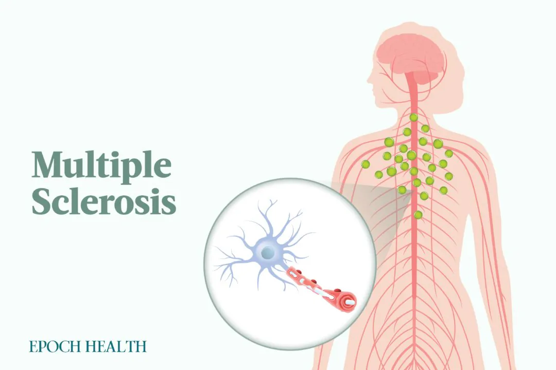 MS typically manifests between the ages of 20 and 40 and is the most common disabling neurological disease in young adults. (Illustrations by The Epoch Times, Shutterstock)