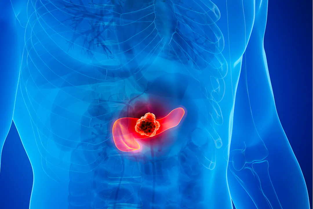 FDA Approves New Treatment for Metastatic Pancreatic Cancer