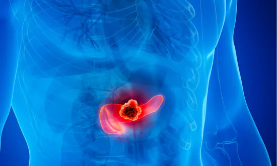 Insulin Resistance Is Silent Driver of Pancreatic Cancer: Study