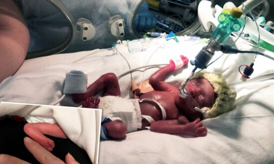 Premature Baby Whose Foot Was the Size of His Mom's Index Finger Has Defied the Odds Is Now 2 and Thriving