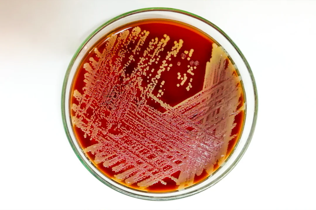 Staph aureus.(Saiful52/Shutterstock)