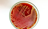 Researchers Identify Bacteria as Cause of Itchy Skin