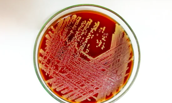 Researchers Identify Bacteria as Cause of Itchy Skin