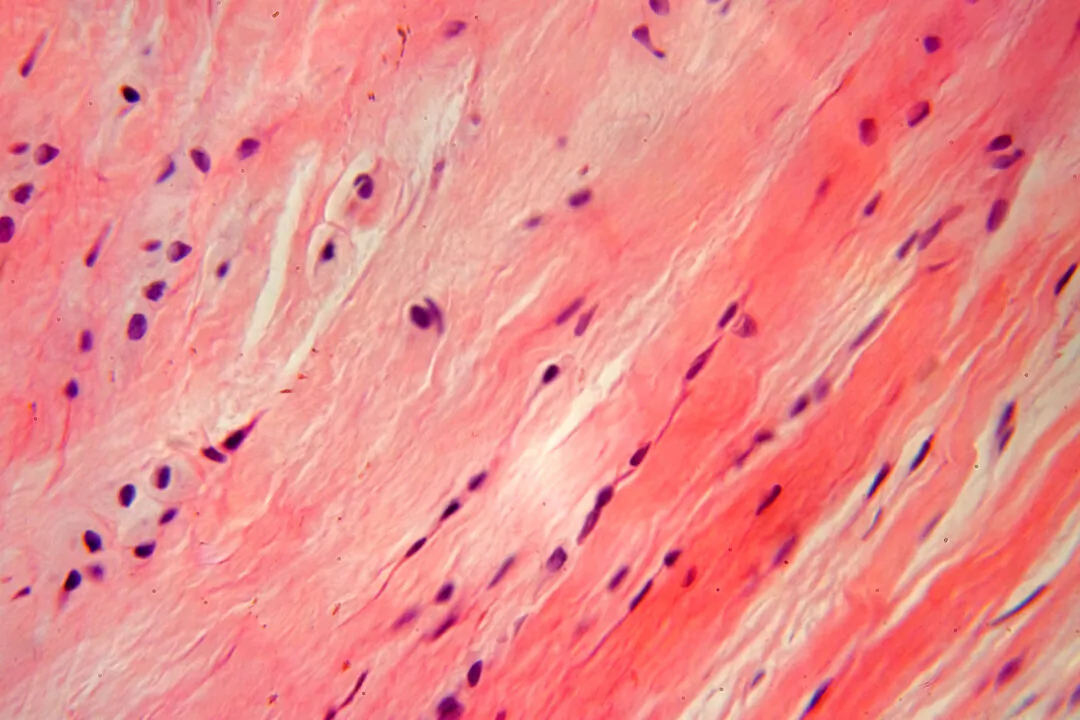 Connective tissue in microscope. (Arkadiusz Wos/Shutterstock)