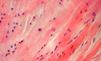 FDA Approves First Treatment for Painful Non-Cancerous Tumors
