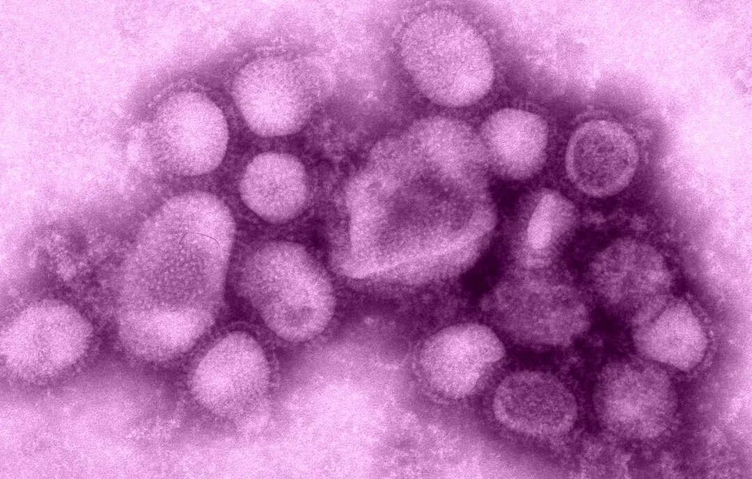 A file photo shows a form of swine flu taken at the U.S. Centers for Disease Control and Prevention's influenza laboratory. (U.S. CDC via The Epoch Times)