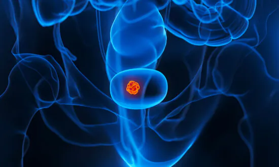 New First-Line Treatment for Bladder Cancer Approved by FDA