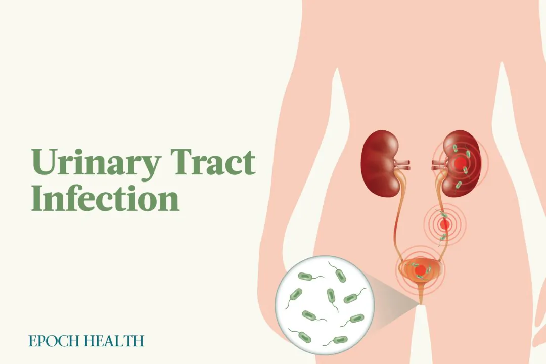Women are 30 times more likely to develop UTIs than men due to their anatomy. (Illustrations by The Epoch Times/Shutterstock)