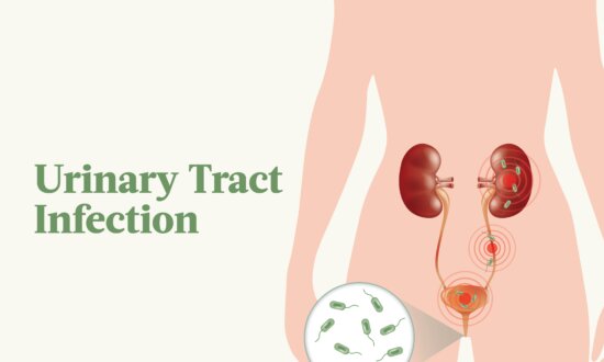 The Essential Guide to Urinary Tract Infections: Symptoms, Causes, Treatments, and Natural Approaches