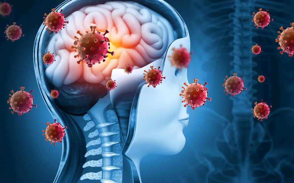 Research Shows Resurgence of Meningitis in France Following COVID-19