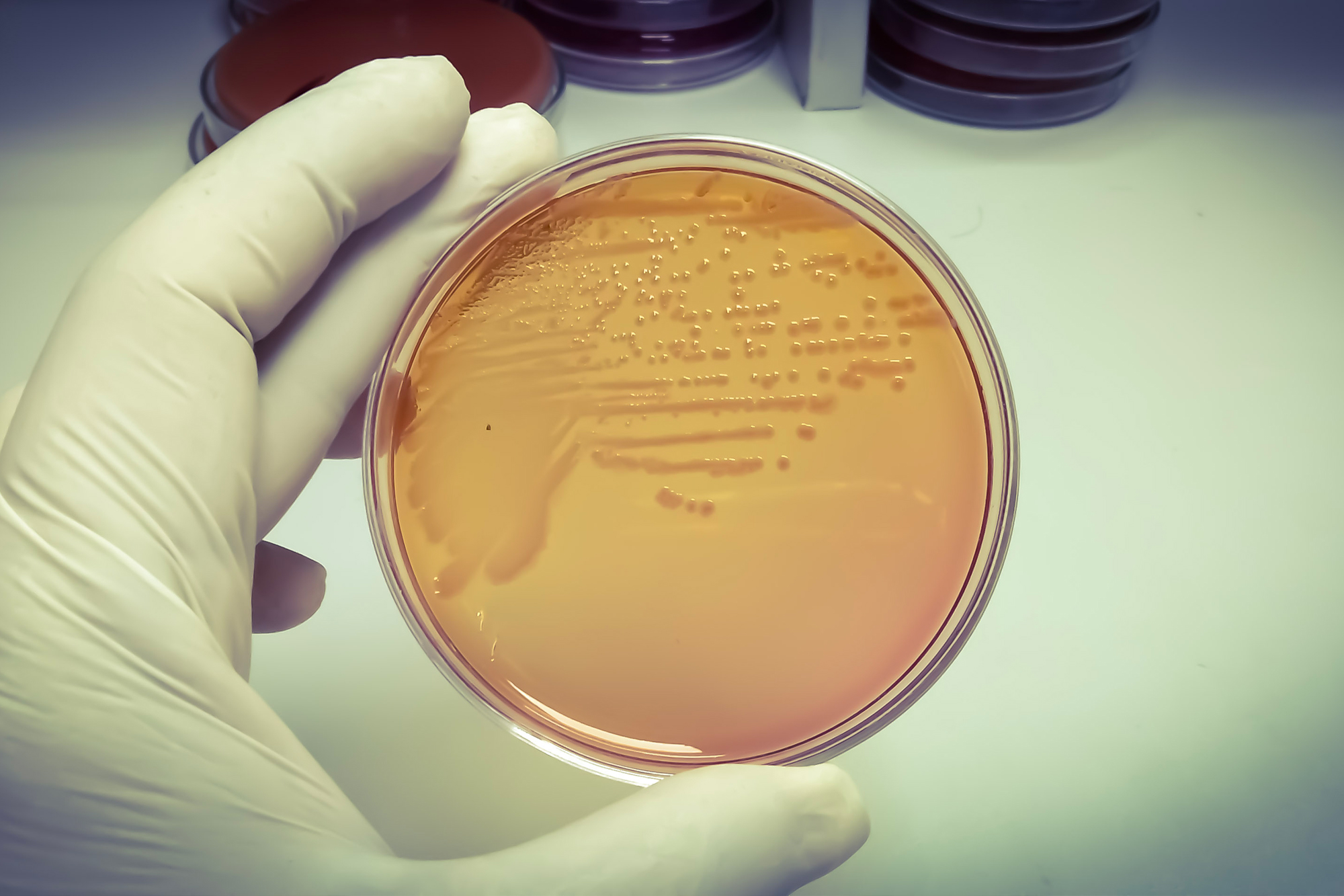 The most reliable way of diagnosing a salmonella infection is culturing the bacteria. (Arif biswas/Shutterstock)