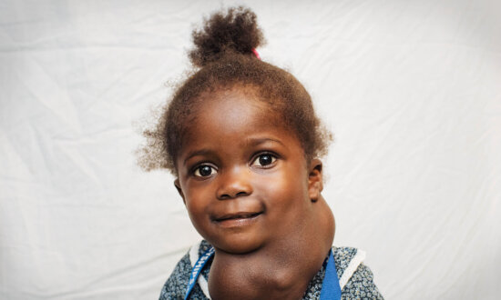 Toddler Was Born With Face-Sized Mass Growing on Her Neck Suffocating Her—Until Surgeon Saves Her