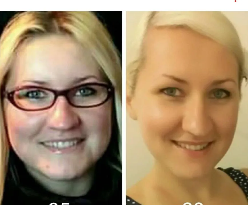 Ann Tankman before and after healing from PCOS, candida and poor vision at the same time, as a result of a diet and lifestyle factors changes. (Photo courtesy of Ann Tankman)