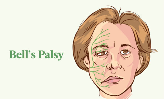 Unexpected Cause of Bell's Palsy