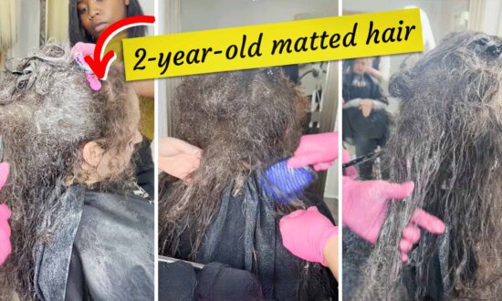 Woman Is Freed From ‘Permanent Headache’ After Salon Spends 10 Hours Detangling Her Matted Hair—See the Amazing Result