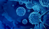 Advanced Prostate Cancer Cases on the Rise After Years of Decline: What You Need to Know