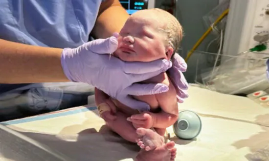 Baby Born Without Eyes and With Half Her Brain Disconnected Baffles Doctors, Hits All Her Milestones