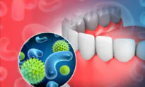 1 in 4 Australians Suffer from Gum Inflammation, Survey Reveals