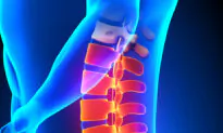 Chiropractic Care May Reduce Need for Future Back Surgeries: Study