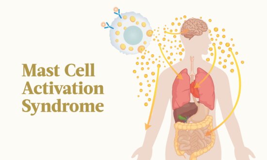 Mast Cell Activation Syndrome: The Myriad Symptoms and How to Treat It