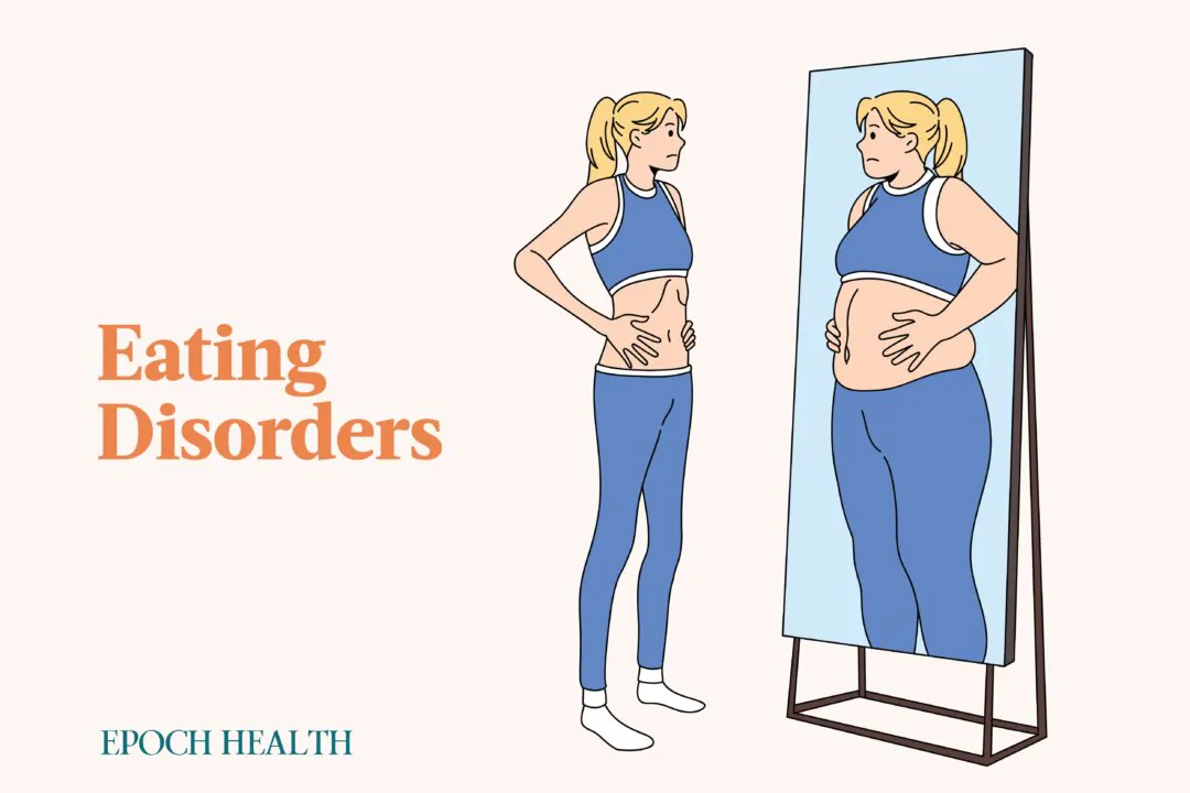 Among the different types of eating disorders, the most common are anorexia nervosa, bulimia, and binge-eating disorder. (Illustrations by The Epoch Times, Shutterstock)