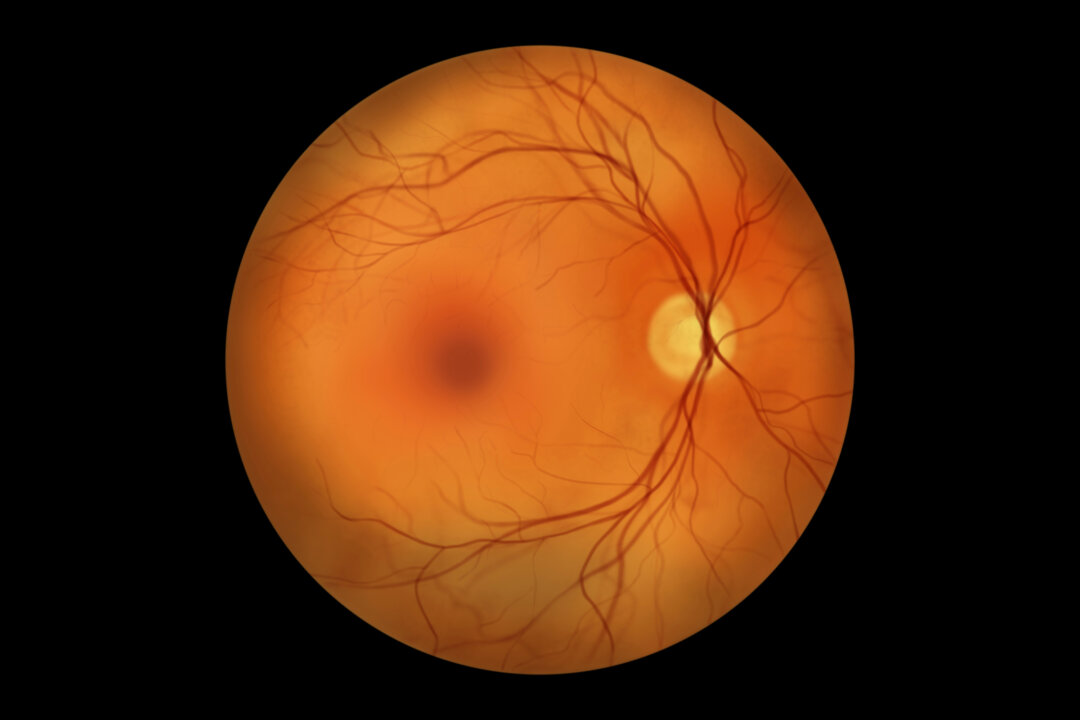 Cholesterol-Lowering Drug Reduces Diabetic Eye Disease by Nearly 30 Percent: Oxford Study