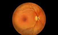 Macular Degeneration: Treatments Seek to Limit or Stop Vision Loss