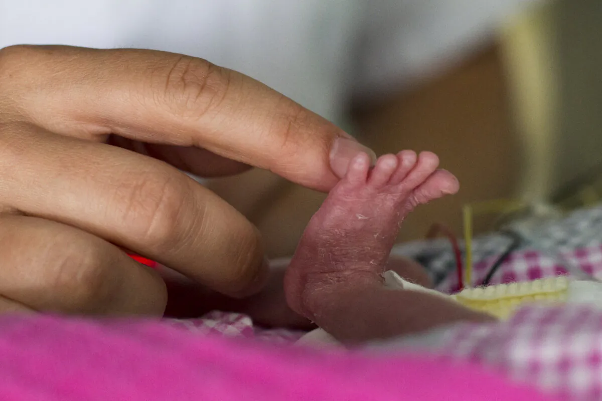 A close up photo of a premature baby's foot in a file photo. Premature birth is one possible symptom of congenital syphilis. (Fred Dufour/AFP via Getty Images)
