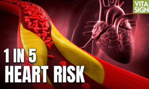 ‘Genetic’ Cholesterol is High in Over 20 Percent of Americans: Leading Heart Doctor Seth Baum MD