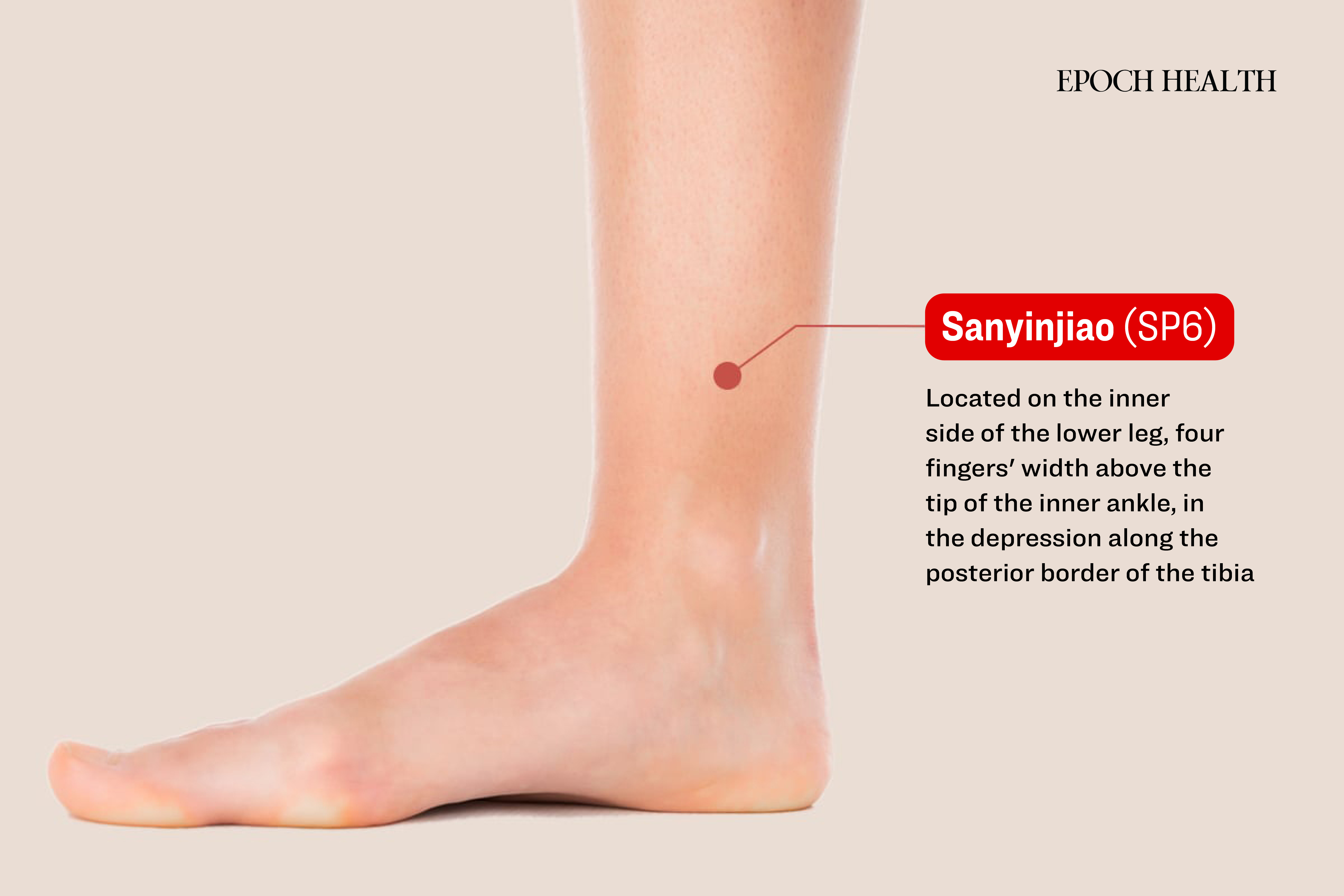 Sanyinjiao acupoint. (The Epoch Times)