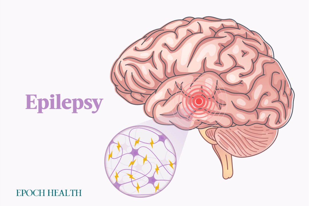 The Essential Guide to Epilepsy Symptoms, Causes, Treatments, and