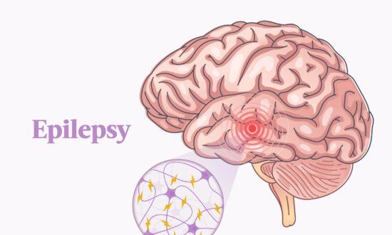 The Essential Guide to Epilepsy: Symptoms, Causes, Treatments, and Natural Approaches