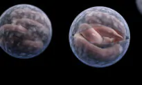 Stay Out of the Pool: Australian Health Officials Sound Alarm as Cryptosporidiosis Cases Spike