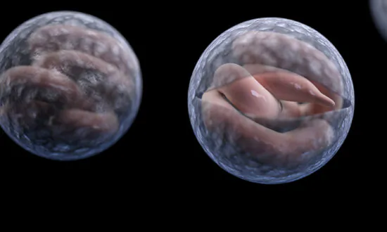 Number of Cryptosporidium Cases Triples in New Zealand