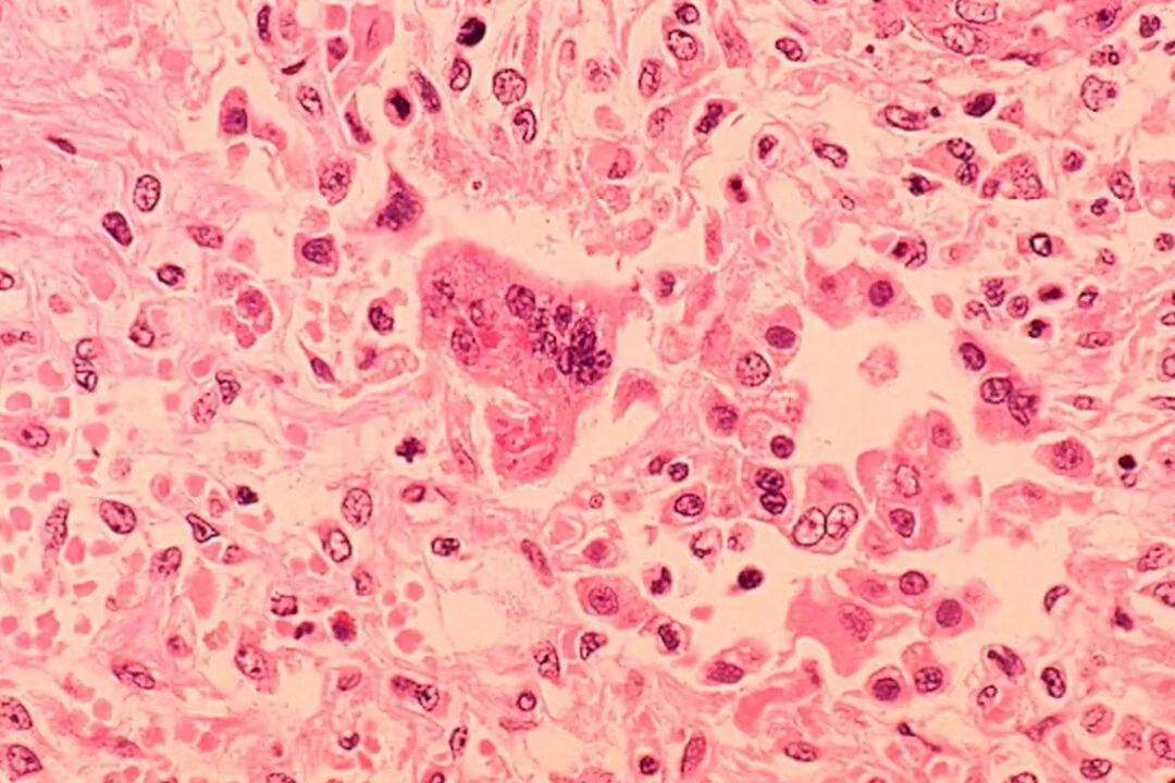 A microscopic image of the measles virus taken in 1972. (CDC/Dr. Edwin P. Ewing, Jr.)