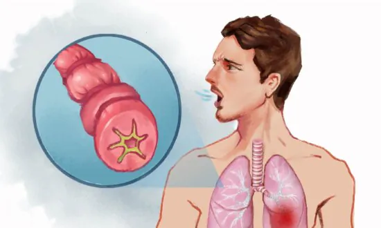 Asthma: Symptoms, Causes, Treatments, and Natural Approaches