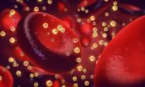 Many Chronic Diseases May Be ‘Rooted’ in Metabolic Dysfunction: Doctor