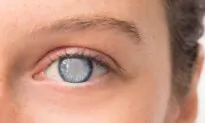 Daily Practice of Ancient Eye Care Exercises Reversed One Patient’s Cataracts in 6 Months