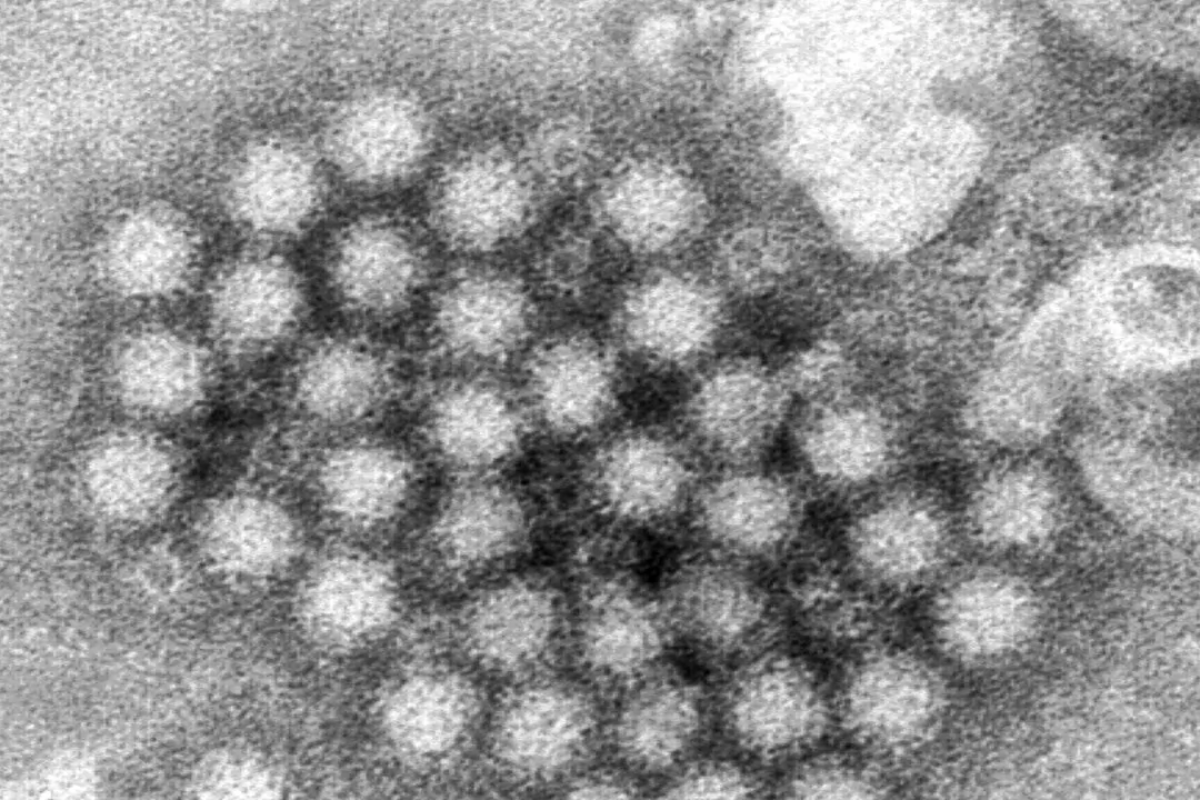 A cluster of norovirus virions. (Charles D. Humphrey/CDC via AP)