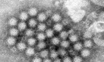 Norovirus Illnesses Are up in Some Places—Here’s What You Need to Know