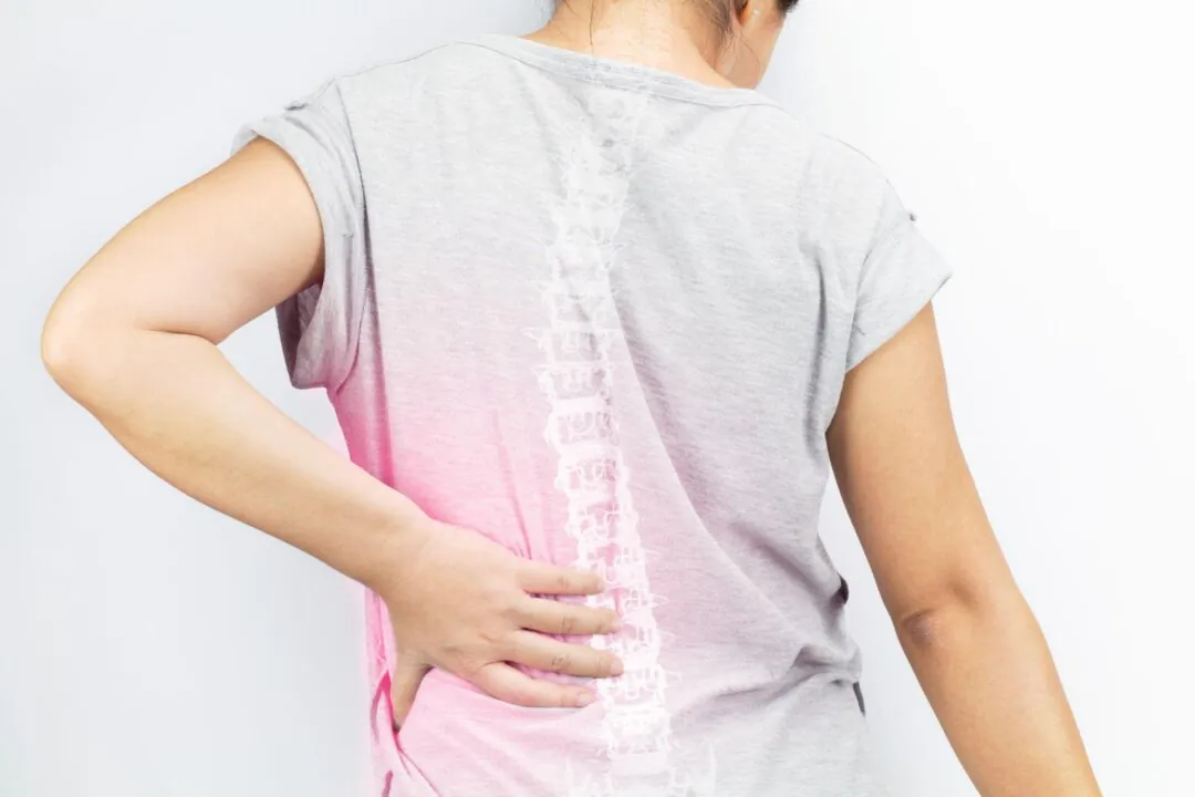 Scoliosis can cause spinal pain and, in severe cases, may affect cardiopulmonary function. (SoftSheep/Shutterstock)