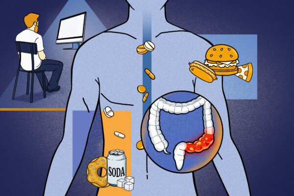 Colorectal Cancer Is Striking Young People, and 'Some New Exposures' May Be Fueling It