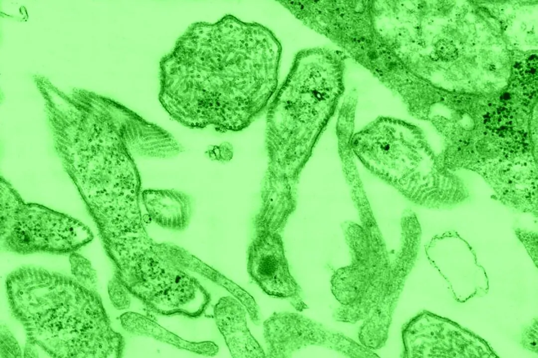 A transmission electron microscopic (TEM) shows the mumps virus. (US Centers for Disease Control and Prevention)