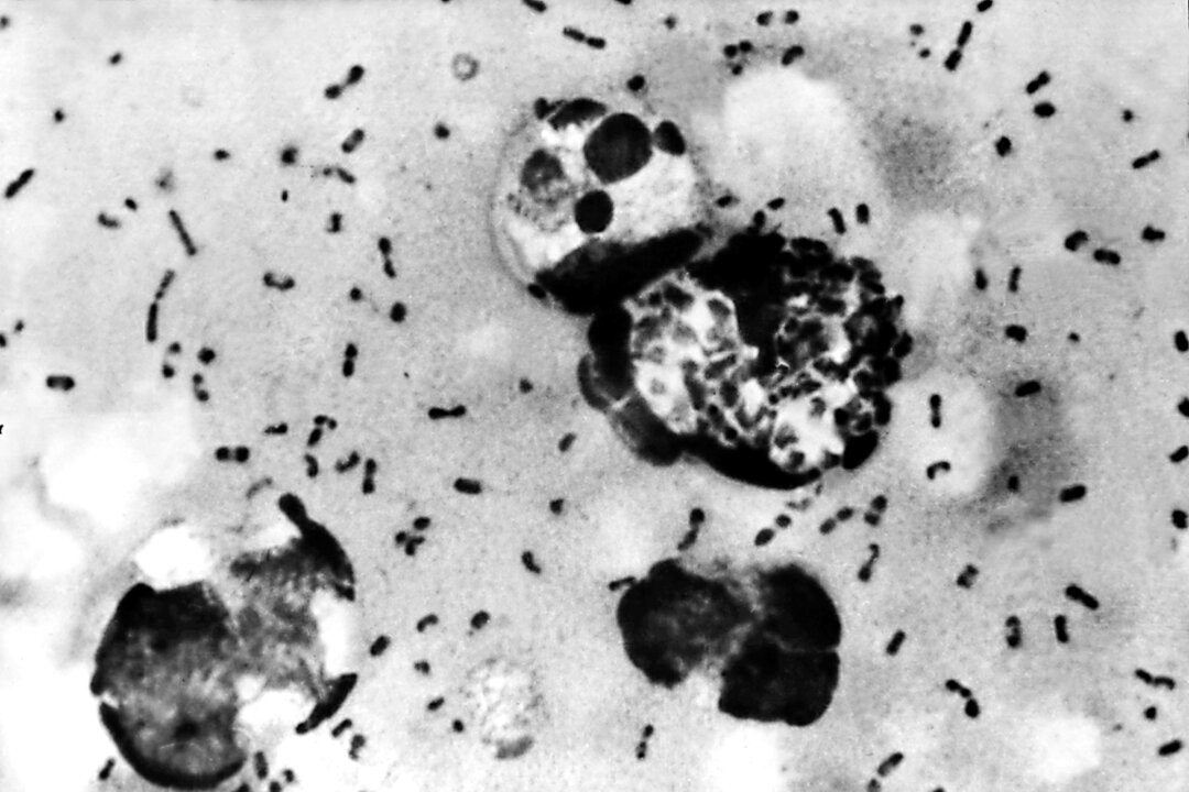 Russian Health Officials Implement Measures After Anti-Plague Research Lab Worker’s Death