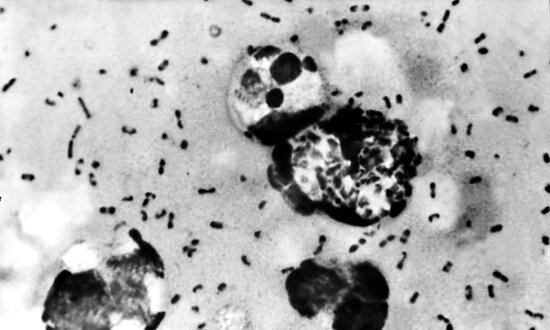 1st US Plague Death in Years