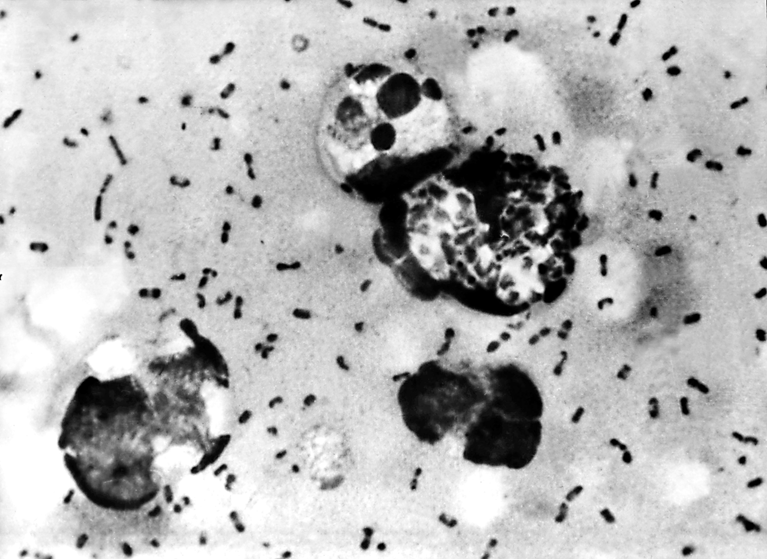 Vials Of Bacteria That May Cause Plague Missing From Tx University
