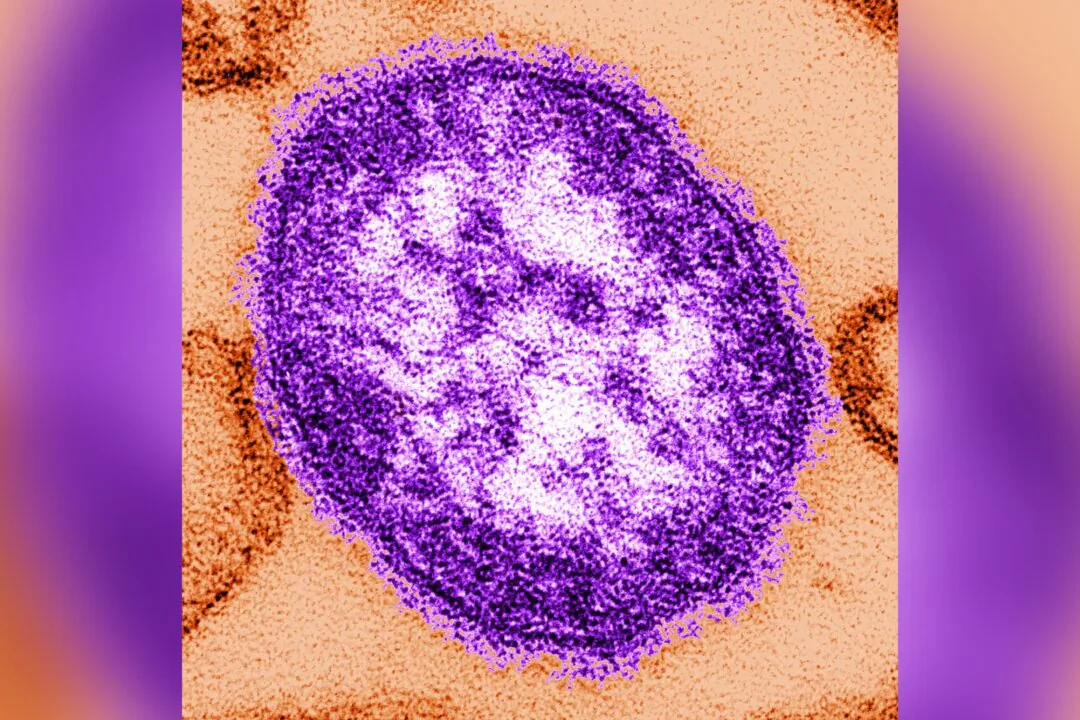 A thin-section transmission electron micrograph (TEM) reveals the ultrastructural appearance of a single virus particle, or “virion,” of the measles virus. (CDC via Getty Images)