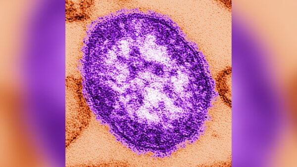 CDC Updates Measles Travel Advisory, Outbreaks Now in 46 Countries Outside of US