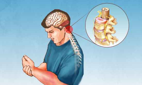 Complex Regional Pain Syndrome: Symptoms, Causes, Treatments, and Natural Approaches